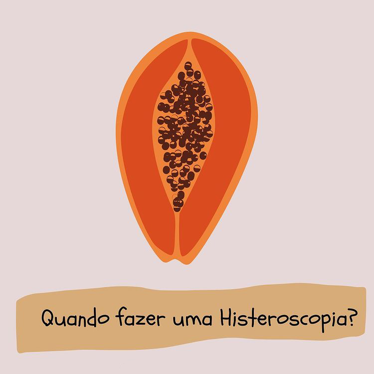 Quando fazer uma histeroscopia?