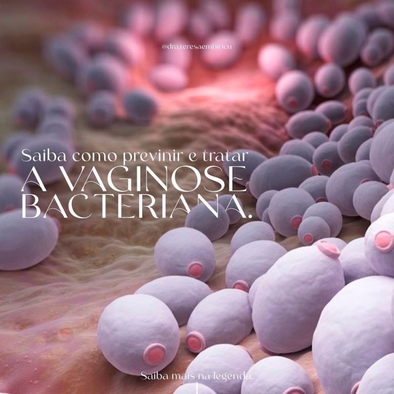vaginose bacteriana