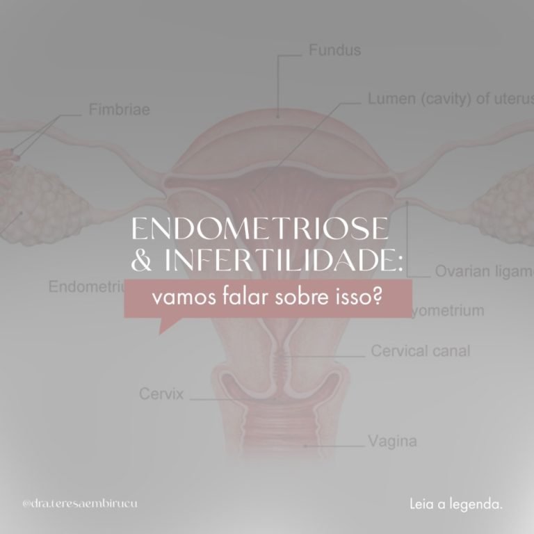 endometriose e a fertilidade